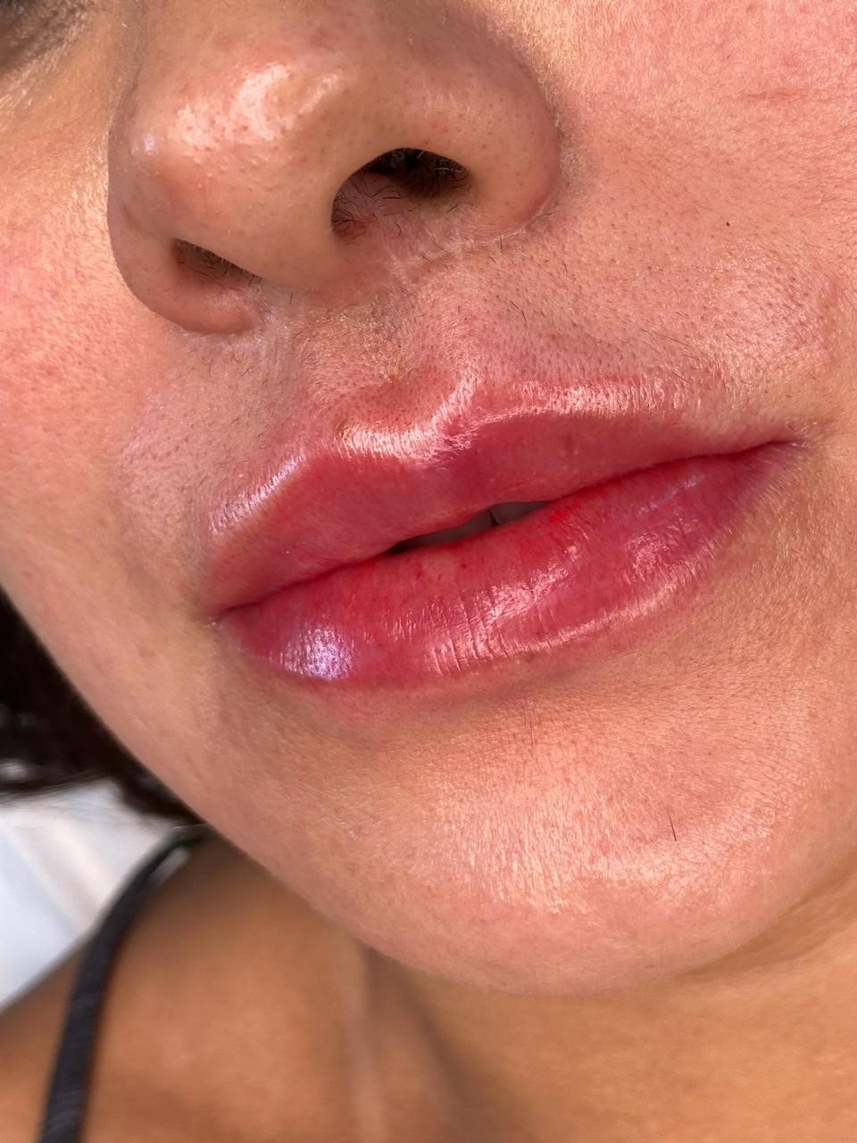 Color Lux Lips — micropigmentação labial na A.S Clinic Estética, Pituba, Salvador